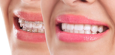 A close-up of two smiling faces with pink lipstick.