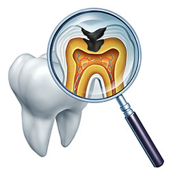 The image shows a magnified view of a tooth with an open crown, revealing its interior structure, including the root canal and pulp chamber, along with an X-ray film placed within a dental magnifying glass, displaying the same tooth s radiograph with the pulp highlighted in yellow.
