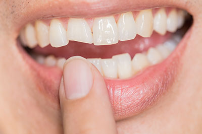 The image shows a close-up of a person s mouth with a toothbrush held between their teeth, emphasizing dental hygiene.
