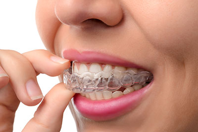 The image shows a person with a wide smile, holding a toothpaste tablet near their mouth, which is covered with braces.