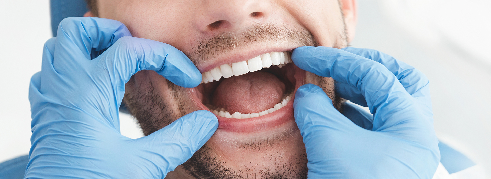 A man wearing blue gloves holds his mouth open wide with a look of discomfort or pain.