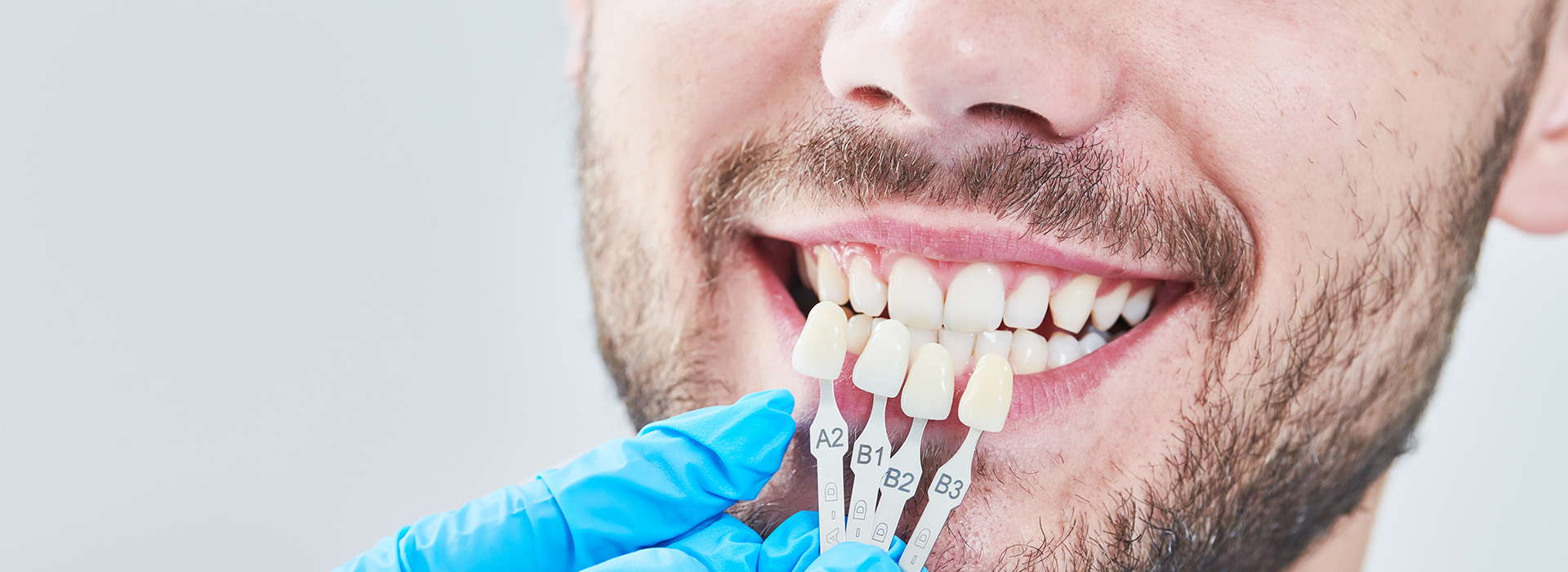 A man with a toothy smile receiving dental treatment with a blue surgical drape around his neck.